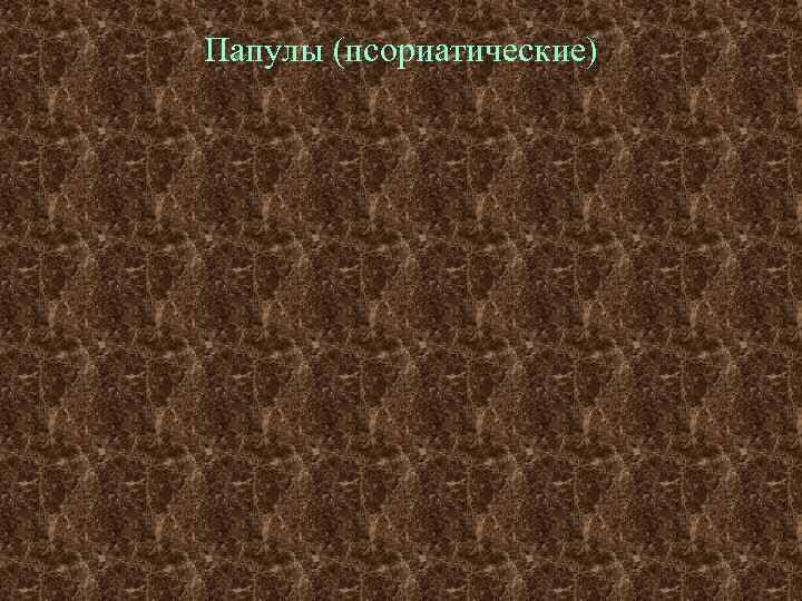 Папулы (псориатические) 