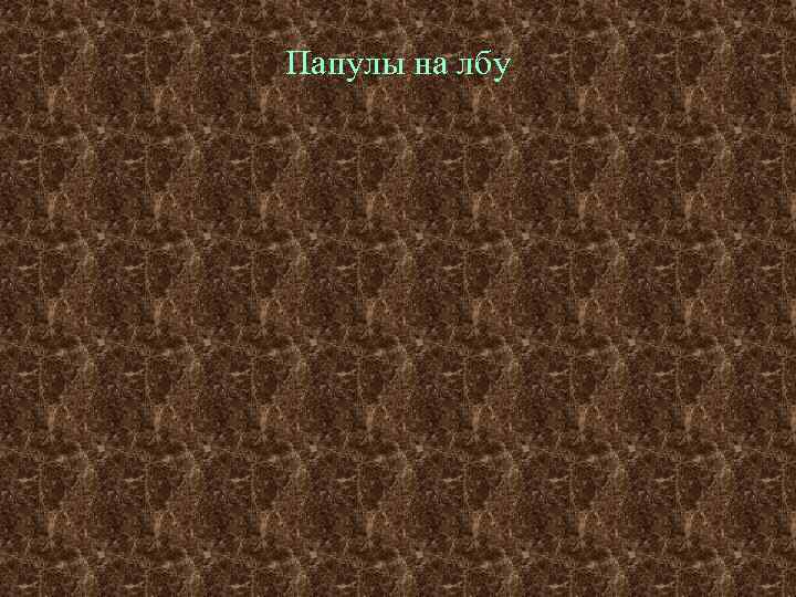 Папулы на лбу 