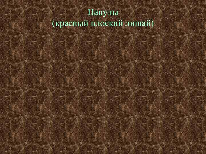   Папулы (красный плоский лишай) 