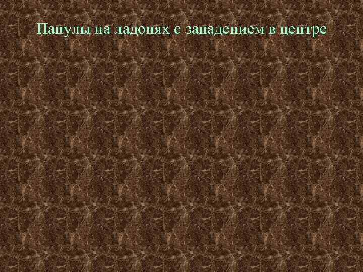 Папулы на ладонях с западением в центре 