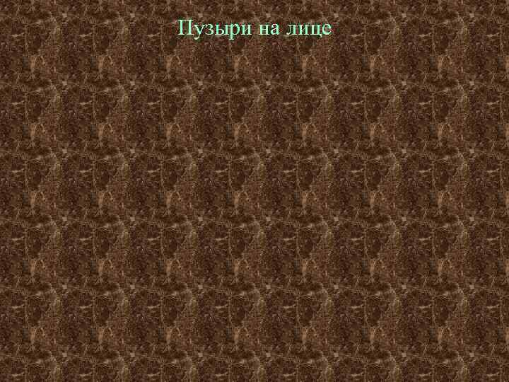 Пузыри на лице 