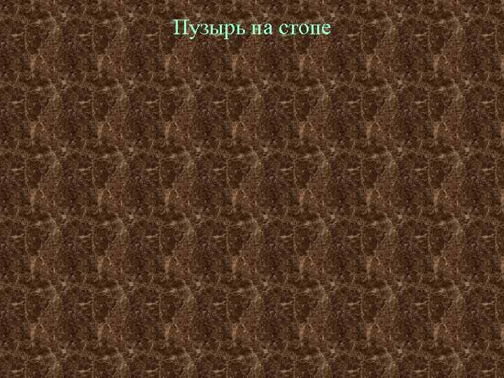 Пузырь на стопе 