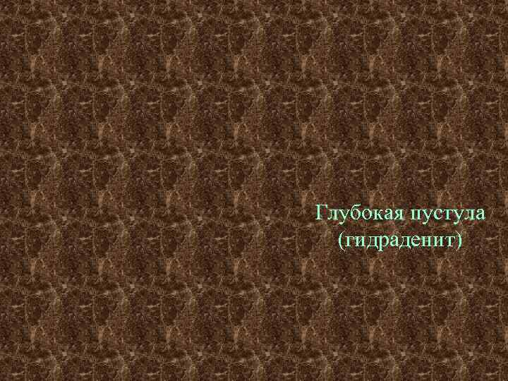 Глубокая пустула  (гидраденит) 