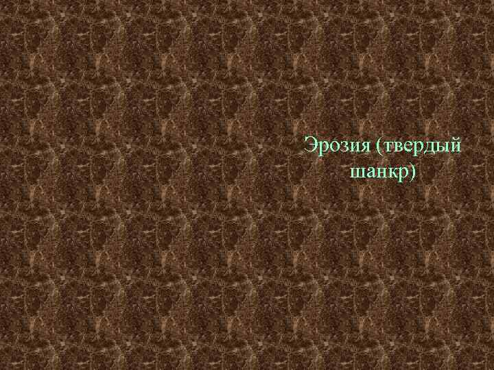 Эрозия (твердый шанкр) 