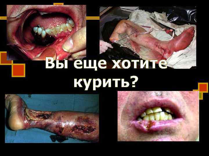 Вы еще хотите курить? Вы еще хотите курить?