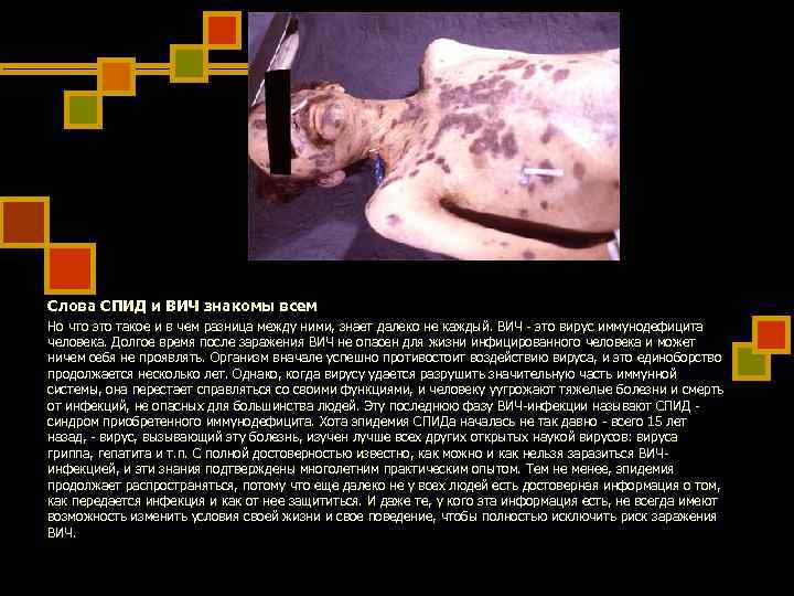 Слова СПИД и ВИЧ знакомы всем Но что это такое и в чем разница Слова СПИД и ВИЧ знакомы всем Но что это такое и в чем разница