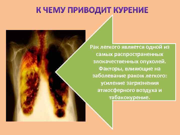 Рак легкого является одной из самых распространенных злокачественных опухолей. Факторы, влияющие на Рак легкого является одной из самых распространенных злокачественных опухолей. Факторы, влияющие на