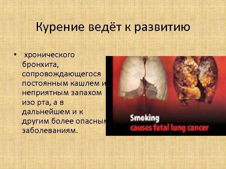 Курение ведёт к развитию • хронического бронхита, сопровождающегося постоянным Курение ведёт к развитию • хронического бронхита, сопровождающегося постоянным
