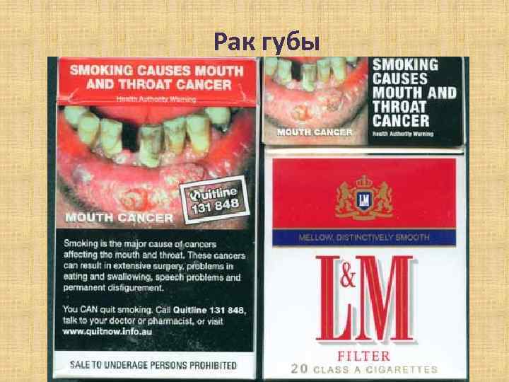 Рак губы Рак губы