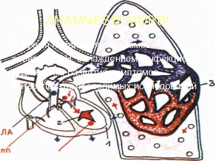   ANAMNESIS MORBI •  Время появления симптомов •  Связь с ФН,