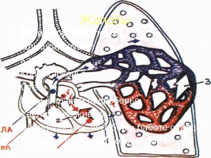     Жалобы •  Боли в грудной клетке •  Одышка,