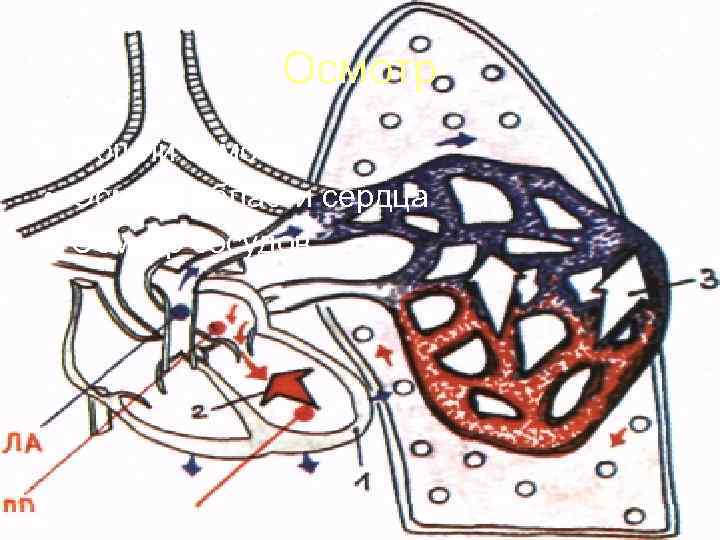    Осмотр • Общий осмотр • Осмотр области сердца • Осмотр сосудов