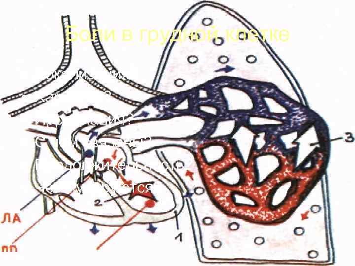   Боли в грудной клетке •  Локализация?  •  Характер? 
