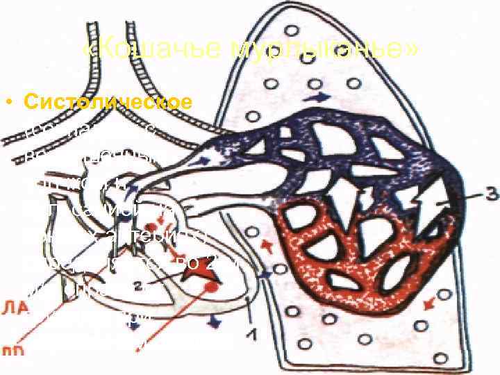   «Кошачье мурлыканье»  • Систолическое  (совпадает с  верхушечным  толчком
