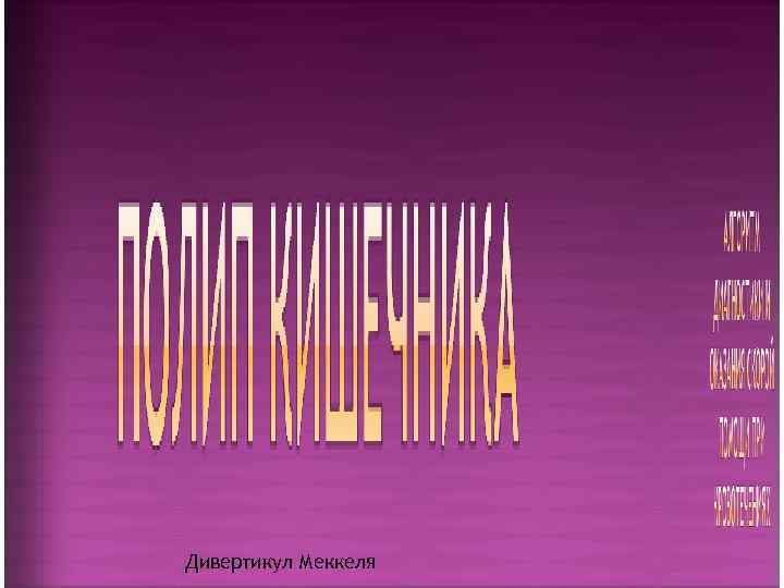 Дивертикул Меккеля 