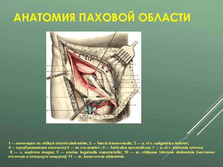 АНАТОМИЯ ПАХОВОЙ ОБЛАСТИ 1 — апоневроз m. obliqui externi abdominis; 2 — fascia