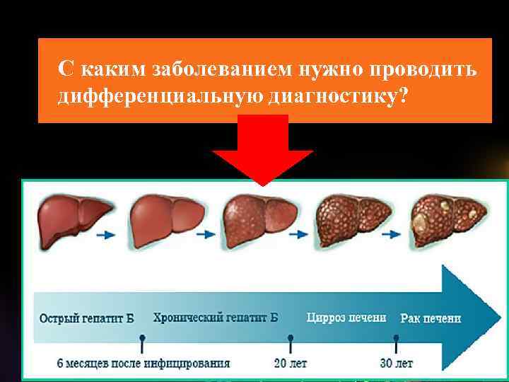 С каким заболеванием нужно проводить дифференциальную диагностику? 