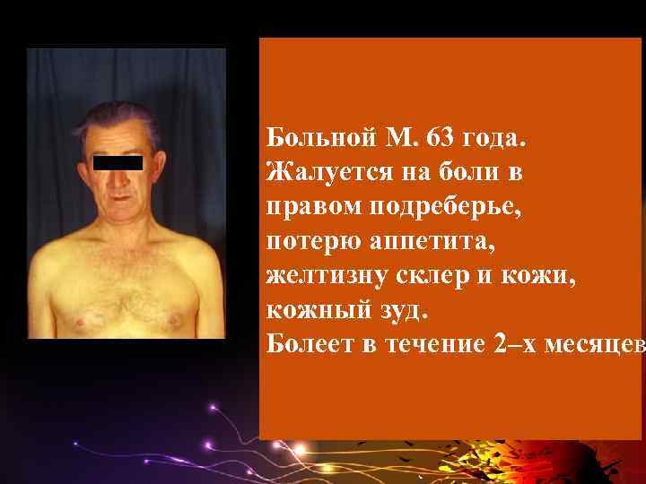 Больной М. 63 года. Жалуется на боли в правом подреберье, потерю аппетита, желтизну склер