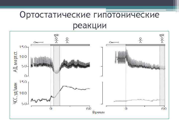 Ортостатические гипотонические реакции Ортостатические гипотонические реакции
