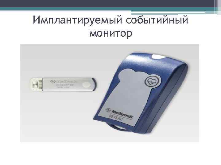 Имплантируемый событийный монитор Имплантируемый событийный монитор