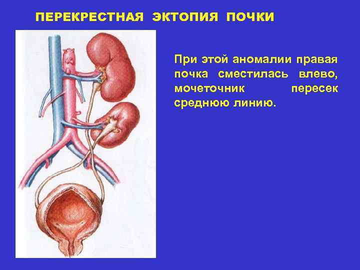 Мочеточник у мужчин фото