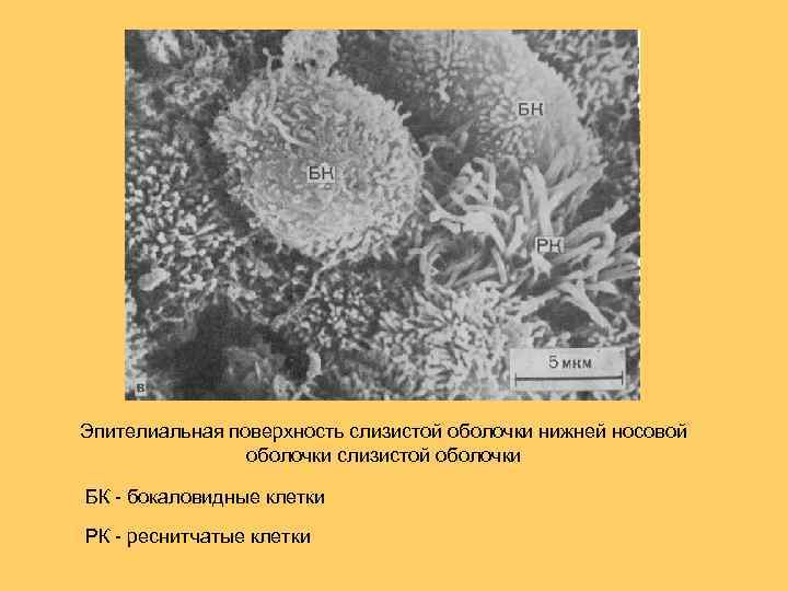 Эпителиальная поверхность слизистой оболочки нижней носовой оболочки слизистой оболочки БК - бокаловидные клетки РК