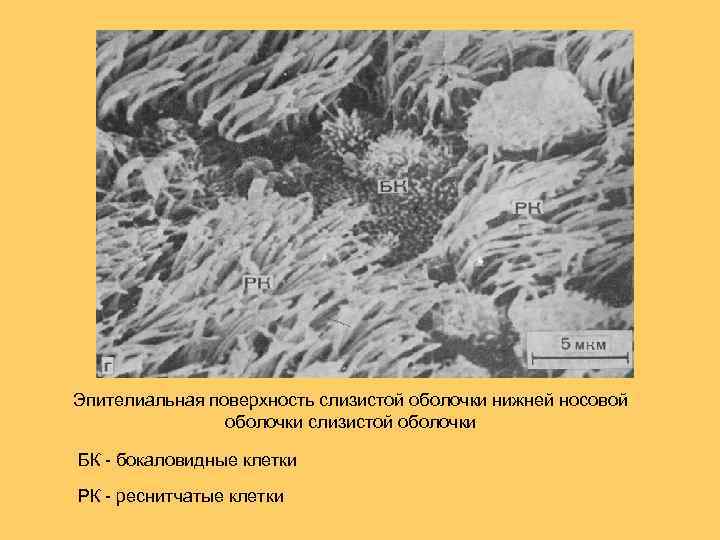 Эпителиальная поверхность слизистой оболочки нижней носовой оболочки слизистой оболочки БК - бокаловидные клетки РК