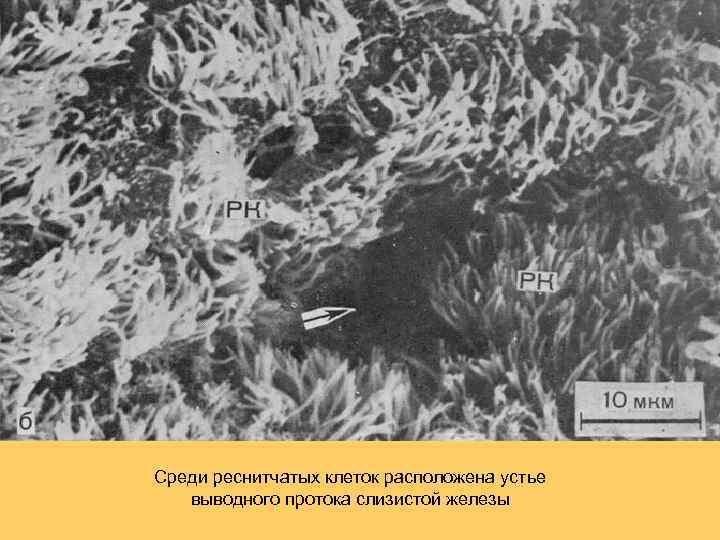 Среди реснитчатых клеток расположена устье выводного протока слизистой железы 