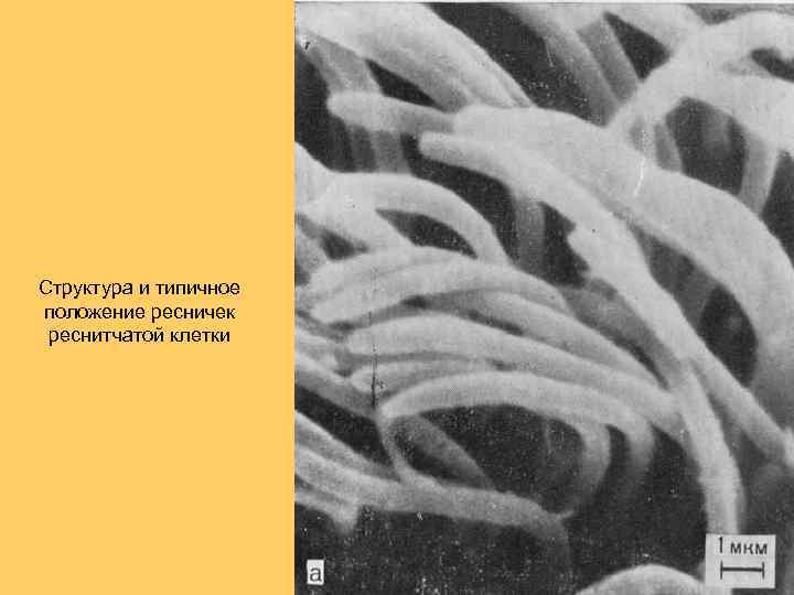 Структура и типичное положение ресничек реснитчатой клетки 