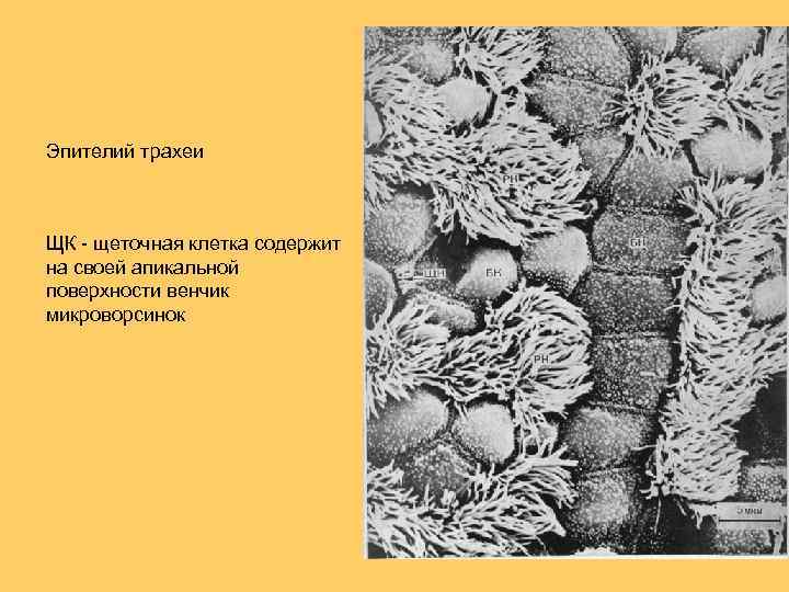 Эпителий трахеи ЩК - щеточная клетка содержит на своей апикальной поверхности венчик микроворсинок 