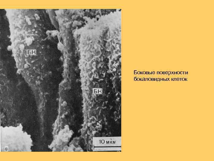 Боковые поверхности бокаловидных клеток 