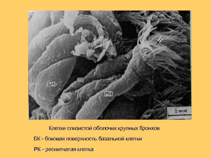Клетки слизистой оболочки крупных бронхов БК - боковая поверхность базальной клетки РК - реснитчатая