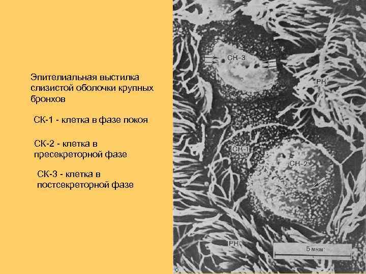 Эпителиальная выстилка слизистой оболочки крупных бронхов СК-1 - клетка в фазе покоя СК-2 -
