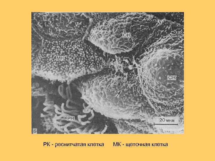 РК - реснитчатая клетка МК - щеточная клетка 