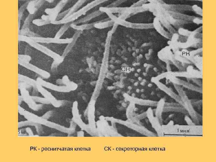 РК - реснитчатая клетка СК - секреторная клетка 