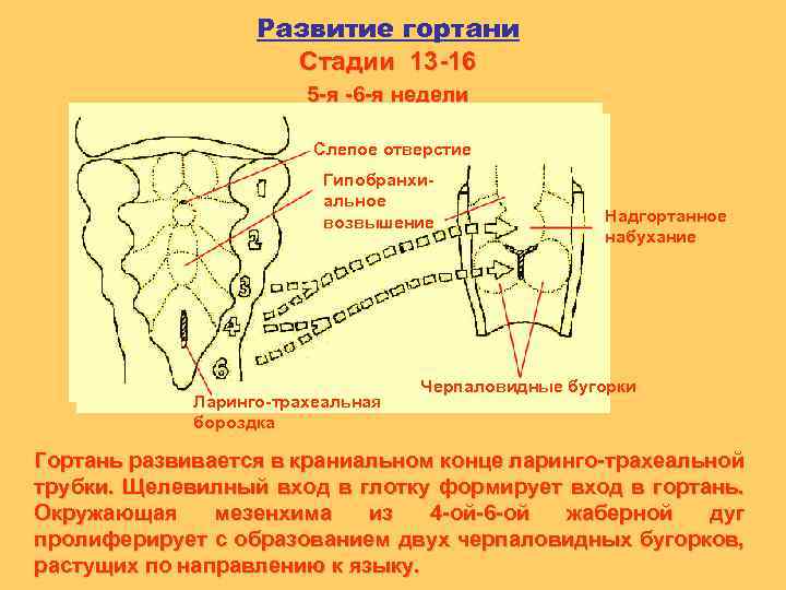 Пороки Развития Трахеи