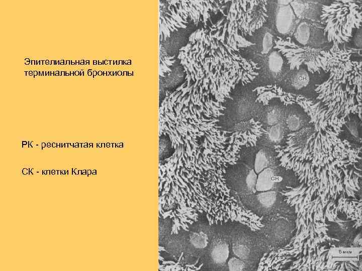 Эпителиальная выстилка терминальной бронхиолы РК - реснитчатая клетка СК - клетки Клара 