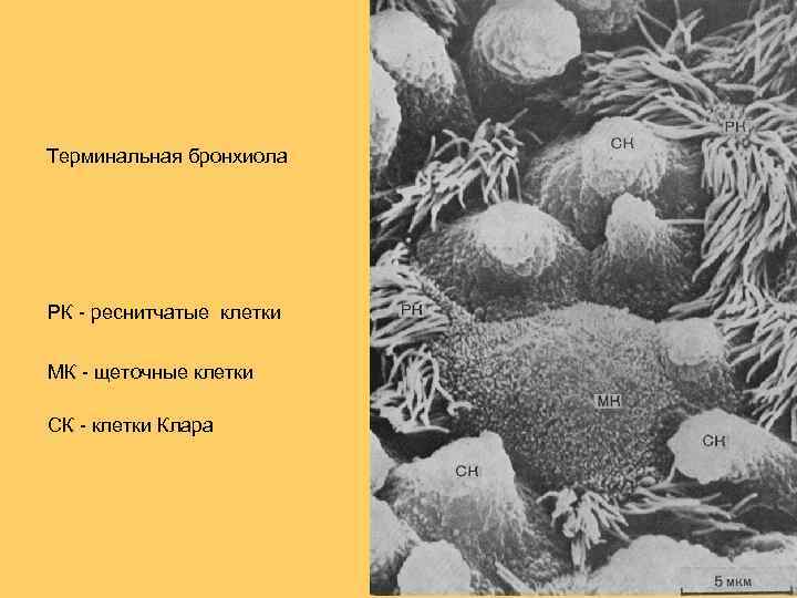 Терминальная бронхиола РК - реснитчатые клетки МК - щеточные клетки СК - клетки Клара