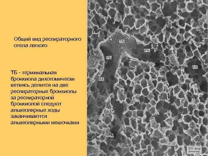 Общий вид респираторного отела легкого ТБ - терминальная бронхиола дихотомически ветвясь делится на две