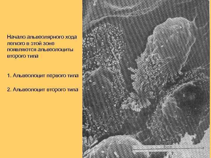 Начало альвеолярного хода легкого в этой зоне появляются альвеолоциты второго типа 1. Альвеолоцит первого