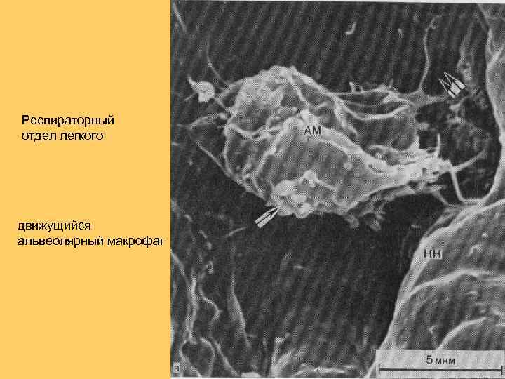 Респираторный отдел легкого движущийся альвеолярный макрофаг 