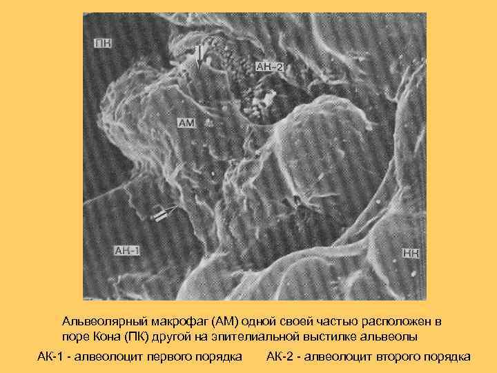Альвеолярный макрофаг (АМ) одной своей частью расположен в поре Кона (ПК) другой на эпителиальной