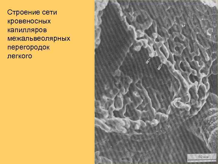 Строение сети кровеносных капилляров межальвеолярных перегородок легкого 