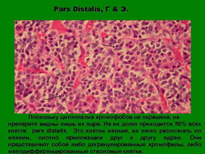 Pars Distalis, Г & Э. Поскольку цитоплазма хромофобов не окрашена, на препарате видны лишь