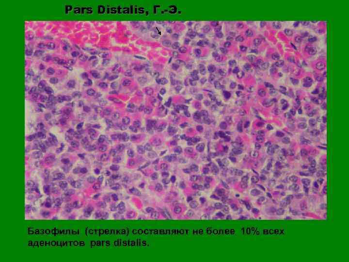 Pars Distalis, Г. -Э. Базофилы (стрелка) составляют не более 10% всех аденоцитов pars distalis.