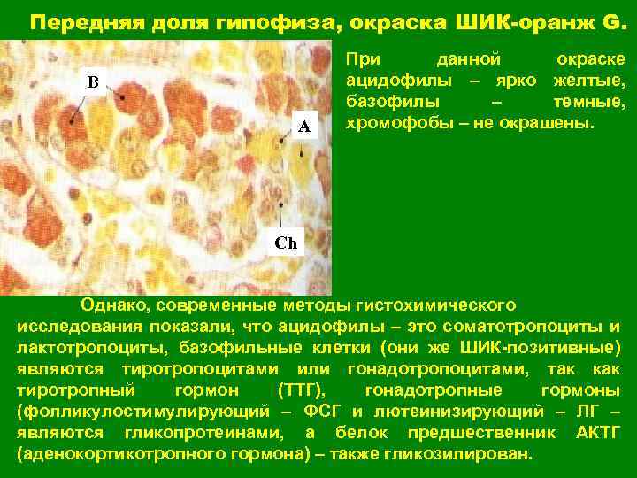 Передняя доля гипофиза, окраска ШИК-оранж G. В А При данной окраске ацидофилы – ярко