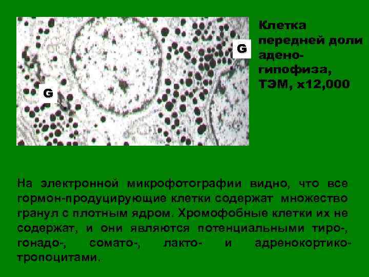 G Клетка передней доли G аденогипофиза, ТЭМ, х12, 000 На электронной микрофотографии видно, что