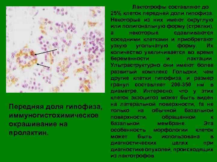 Передняя доля гипофиза, иммуногистохимическое окрашивание на пролактин. Лактотрофы составляют до 25% клеток передней доли