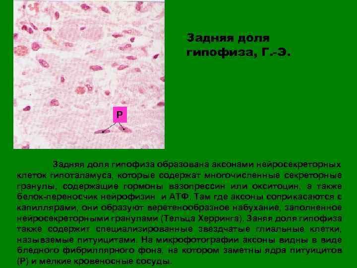 Задняя доля гипофиза, Г. -Э. P Задняя доля гипофиза образована аксонами нейросекреторных клеток гипоталамуса,