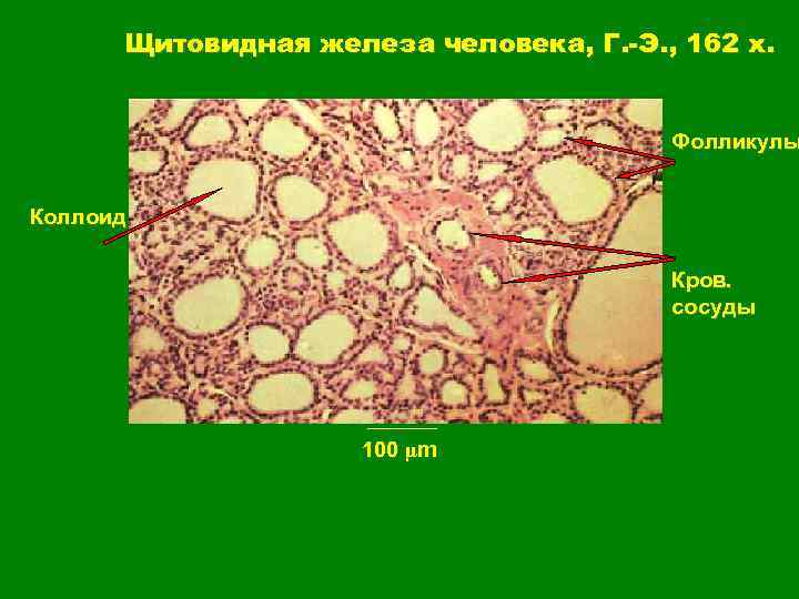 Щитовидная железа человека, Г. -Э. , 162 x. Фолликулы Коллоид Кров. сосуды 100 µm